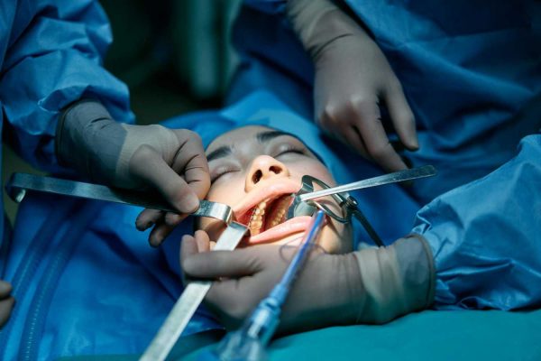 Oral Surgeries